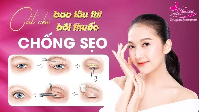 hinh-anh-tiem-filler